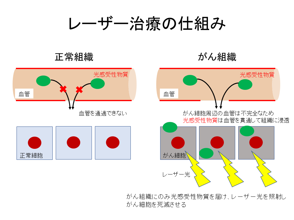 光がん免疫治療法