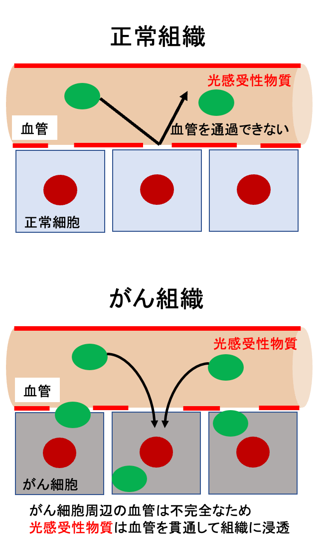 光がん免疫治療法